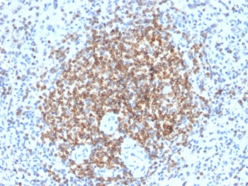 Bcl-2 Antibody