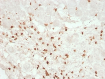 CD8A Antibody