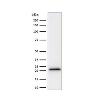 p21 Antibody / CDKN1A