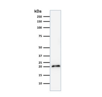 p21 Antibody / CDKN1A