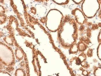EpCAM Antibody / Extracellular domain