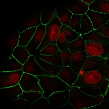 E-Cadherin Antibody / CDH1
