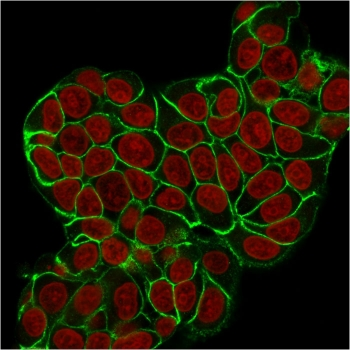 E-Cadherin Antibody / CDH1