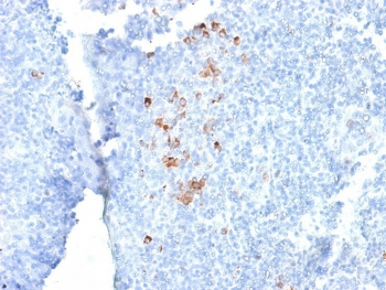 IgG Heavy Chain Antibody