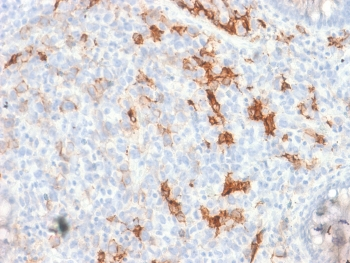 NGF Receptor Antibody / p75NTR / CD271