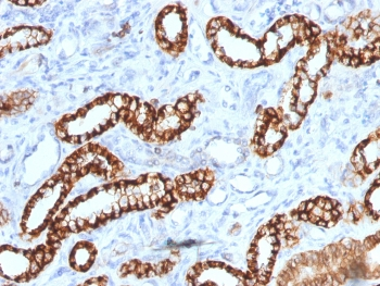 Cadherin 16 Antibody