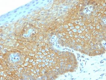 Beta Catenin Antibody