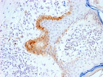KRT15 Antibody / Cytokeratin 15
