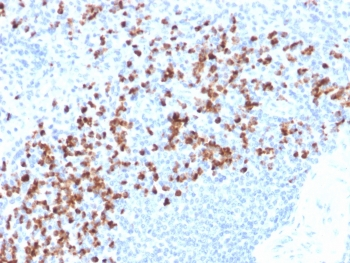 MMP9 Antibody / Matrix metalloproteinase-9