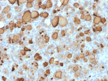TG Antibody / Thyroglobulin