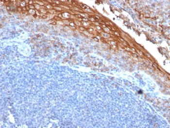 CD146 Antibody / MCAM / MUC18