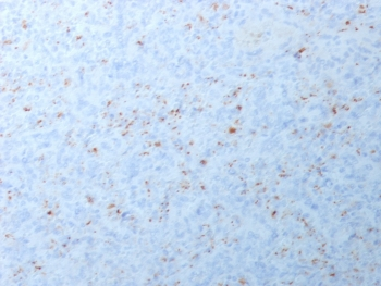 MMP3 Antibody / Matrix Metalloproteinase 3