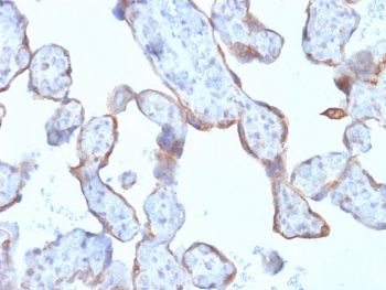 MMP3 Antibody / Matrix Metalloproteinase 3