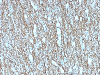 Neurofilament Antibody (-Heavy) / NF-H / NEFH