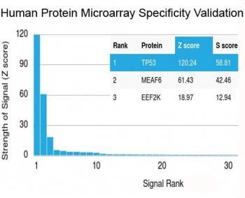 p53 Antibody / TP53 N-Terminal Region