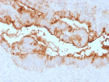 MUC16 Antibody / CA125