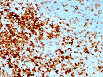 CD43 Antibody