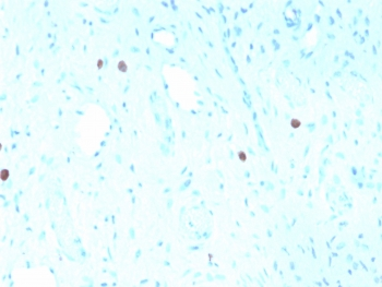 HPV-16 L1 Antibody
