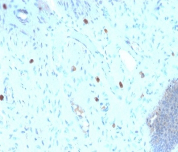 HPV-16 L1 Antibody