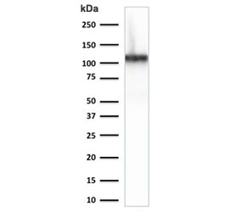 Cadherin 16 Antibody