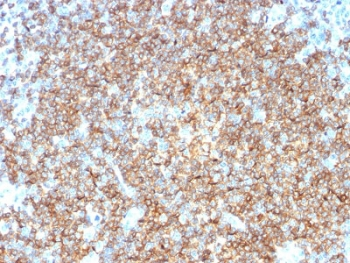 CD22 Antibody
