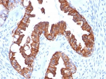 KRT7 Antibody / Cytokeratin 7