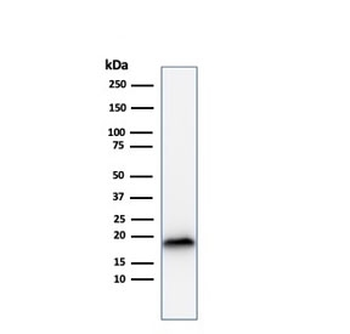 MART-1 / Melan-A Antibody