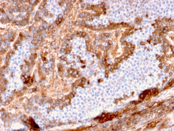 Albumin Antibody / ALB
