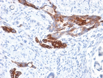 MUC6 Antibody / Gastric Mucin