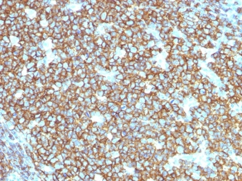 CD20 Antibody