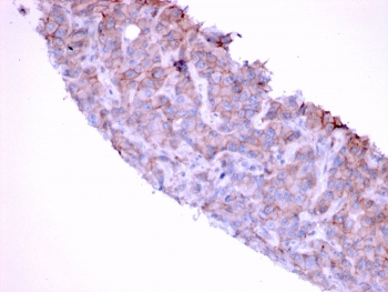 EGF Receptor / EGFR Antibody