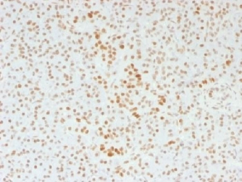 ATRX Antibody / RAD54