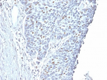 Cyclin A2 Antibody / CCNA2