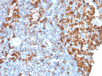IBA1 Antibody / AIF-1