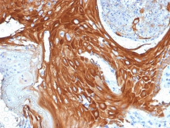 Keratin 6 Antibody / Cytokeratin 6