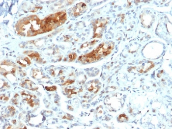 Mammaglobin A Antibody / SCGB2A2