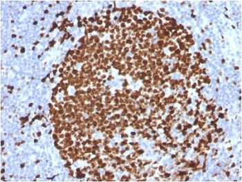 Ki67 Antibody