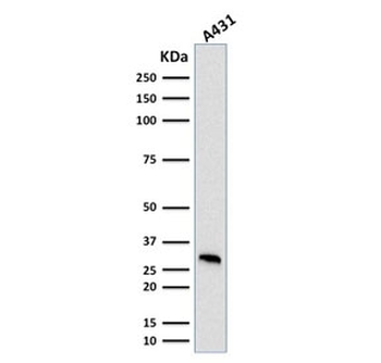 MTAP Antibody