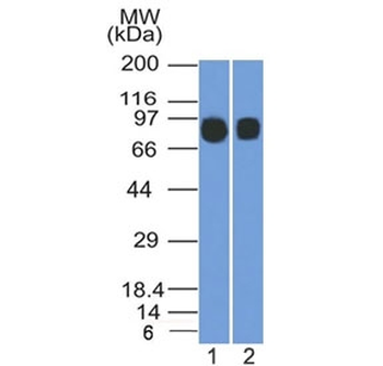 CD10 Antibody / Neprilysin