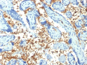 SPTA1 Antibody / Spectrin alpha 1