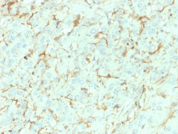 NGF Receptor Antibody / p75NTR / CD271