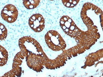 Cytokeratin 20 Antibody / CK20