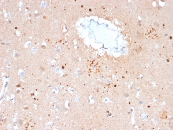 Ubiquitin Antibody