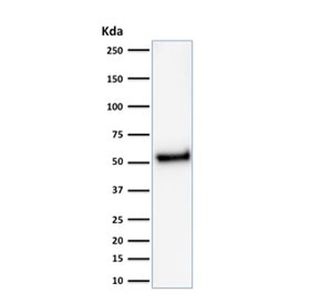 p53 Antibody / TP53