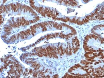p53 Antibody / TP53