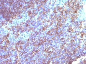 CD45 Antibody (Leukocyte marker)