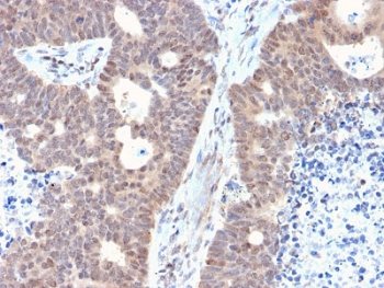 FAF1 Antibody / FAS-associated factor 1