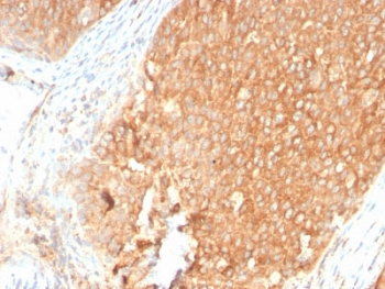 TOP1MT Antibody / Topoisomerase I mitochondrial