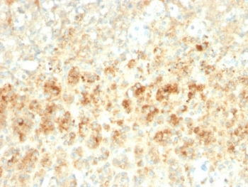 Adipophilin Antibody / Perilipin 2 / ADRP / PLIN2