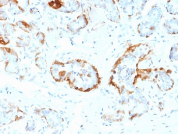 Alpha B Crystallin Antibody / CRYAB